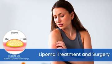 Dr Amita Jain is the best Lipoma Treatment and Surgeon in Delhi